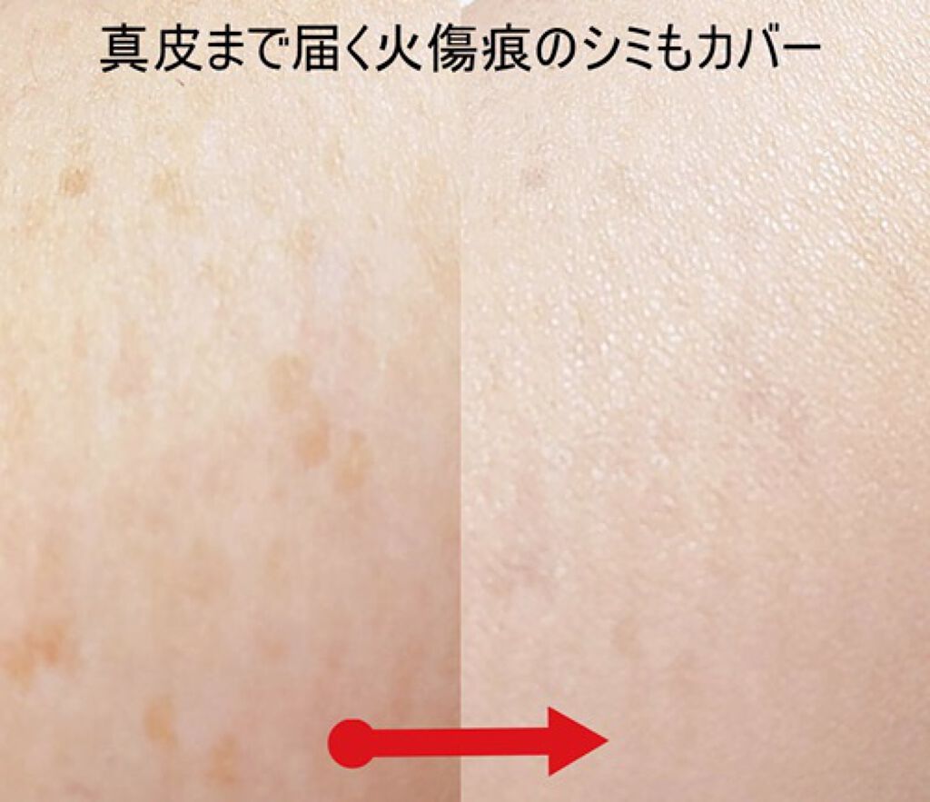 シンクロフィット パクト EX/ESPRIQUE/パウダーファンデーションを使ったクチコミ(2枚目)