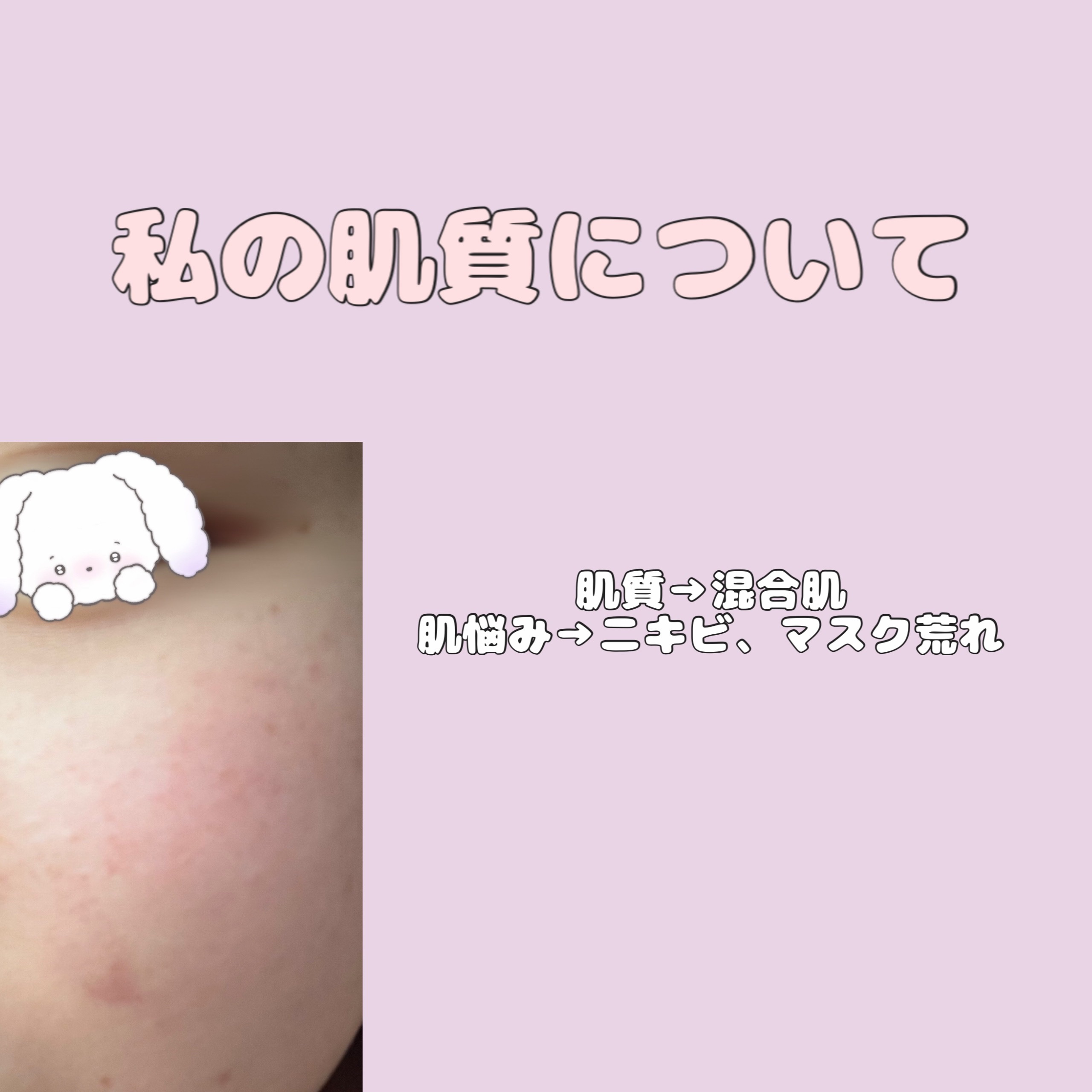 パーフェクトホイップ アクネケア/SENKA（専科）/洗顔フォームを使ったクチコミ（2枚目）