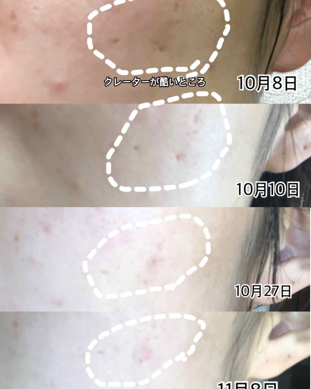 メディカルクリームG(薬用クリームG)/メンターム/ハンドクリームを使ったクチコミ(2枚目)