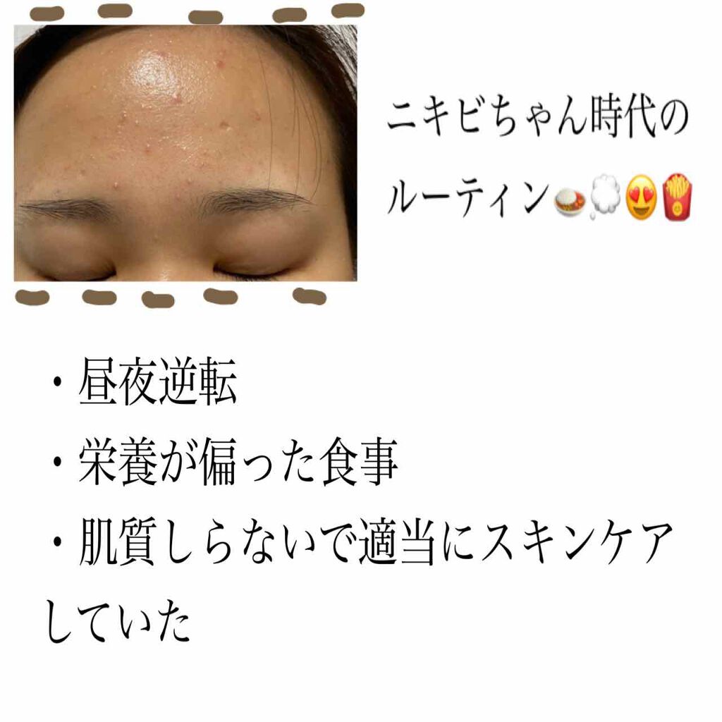 薬用 クリアローション L（さっぱりタイプ）/オルビス/化粧水を使ったクチコミ（2枚目）