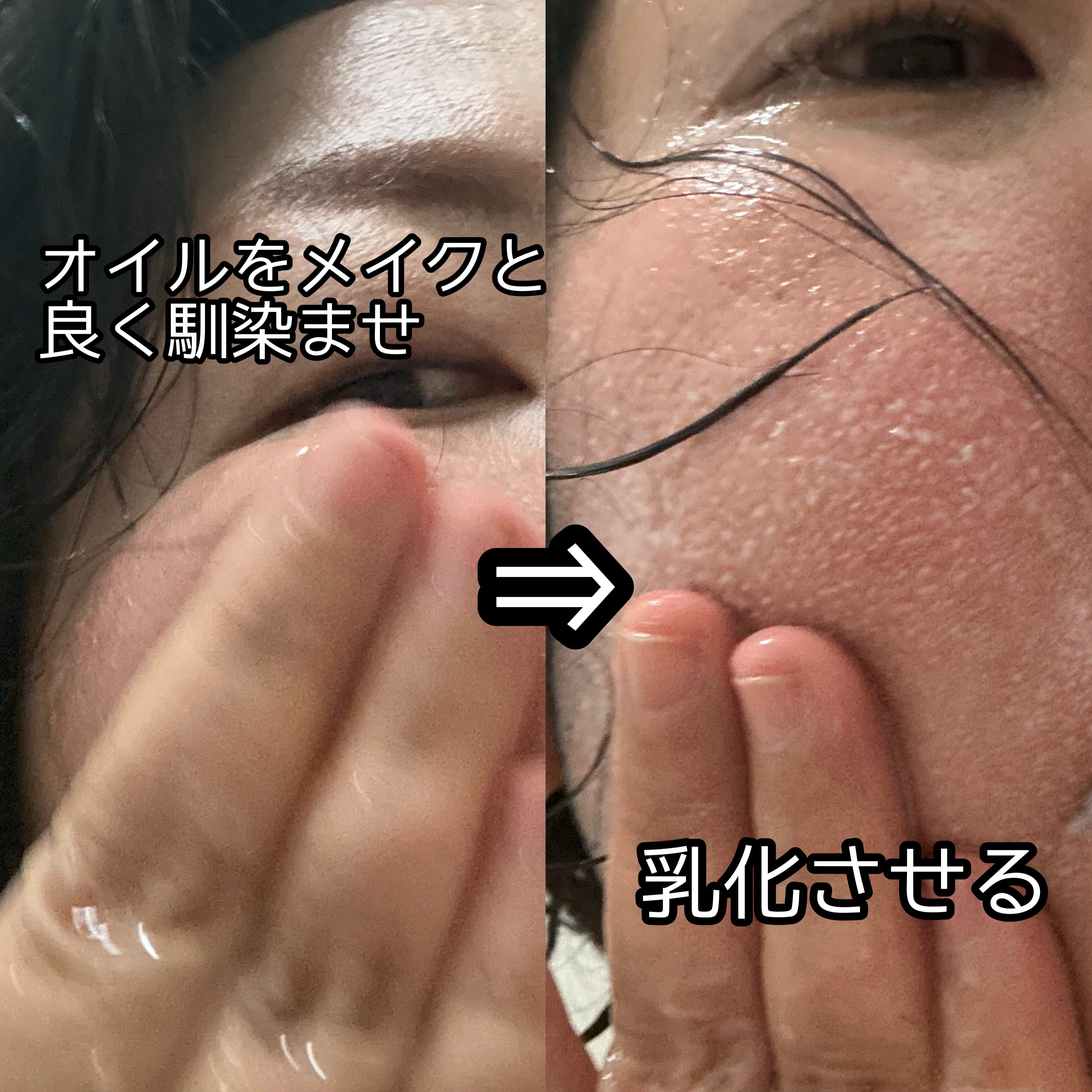 ドクダミ ポアコントロールクレンジングオイル/Anua/オイルクレンジングを使ったクチコミ（2枚目）