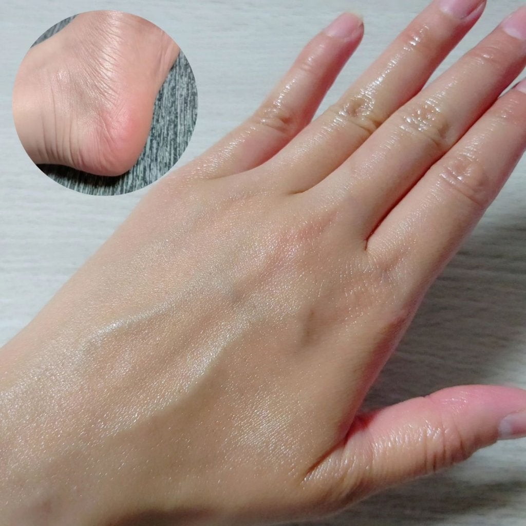 マルチパーパスクリーム/アロジン/ハンドクリームを使ったクチコミ(5枚目)