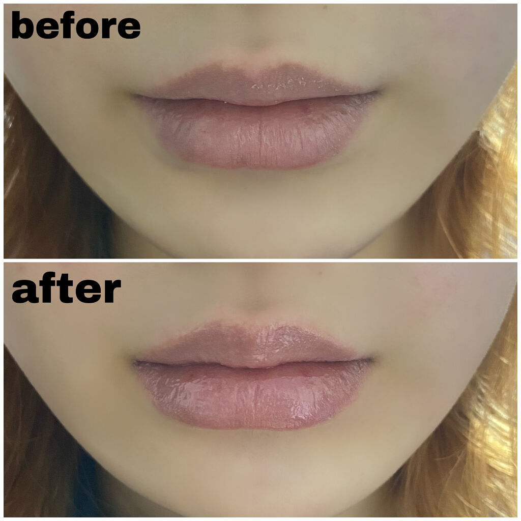 リップトリートメントバーム/LANEIGE/リップケアを使ったクチコミ（2枚目）