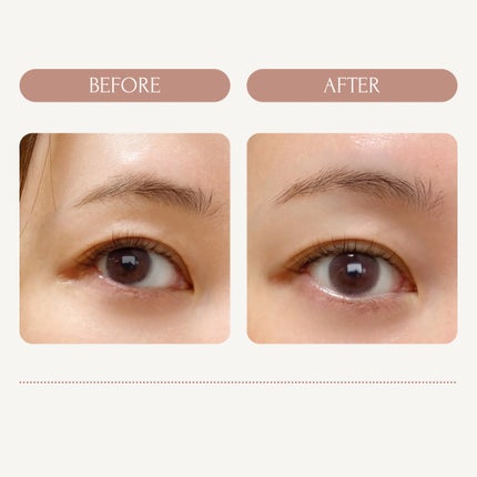 デュアルヘッドシェーバー/ルピリーナ/その他スキンケアグッズを使ったクチコミ(8枚目)