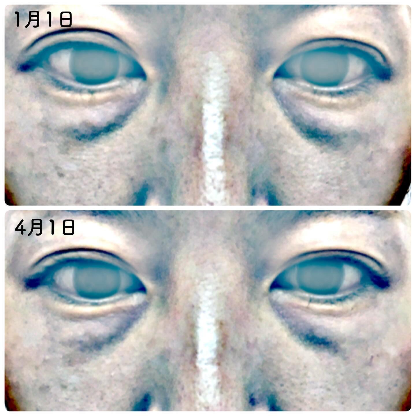 試してみた】Face-Trigger COREFITの効果・肌質別の口コミ