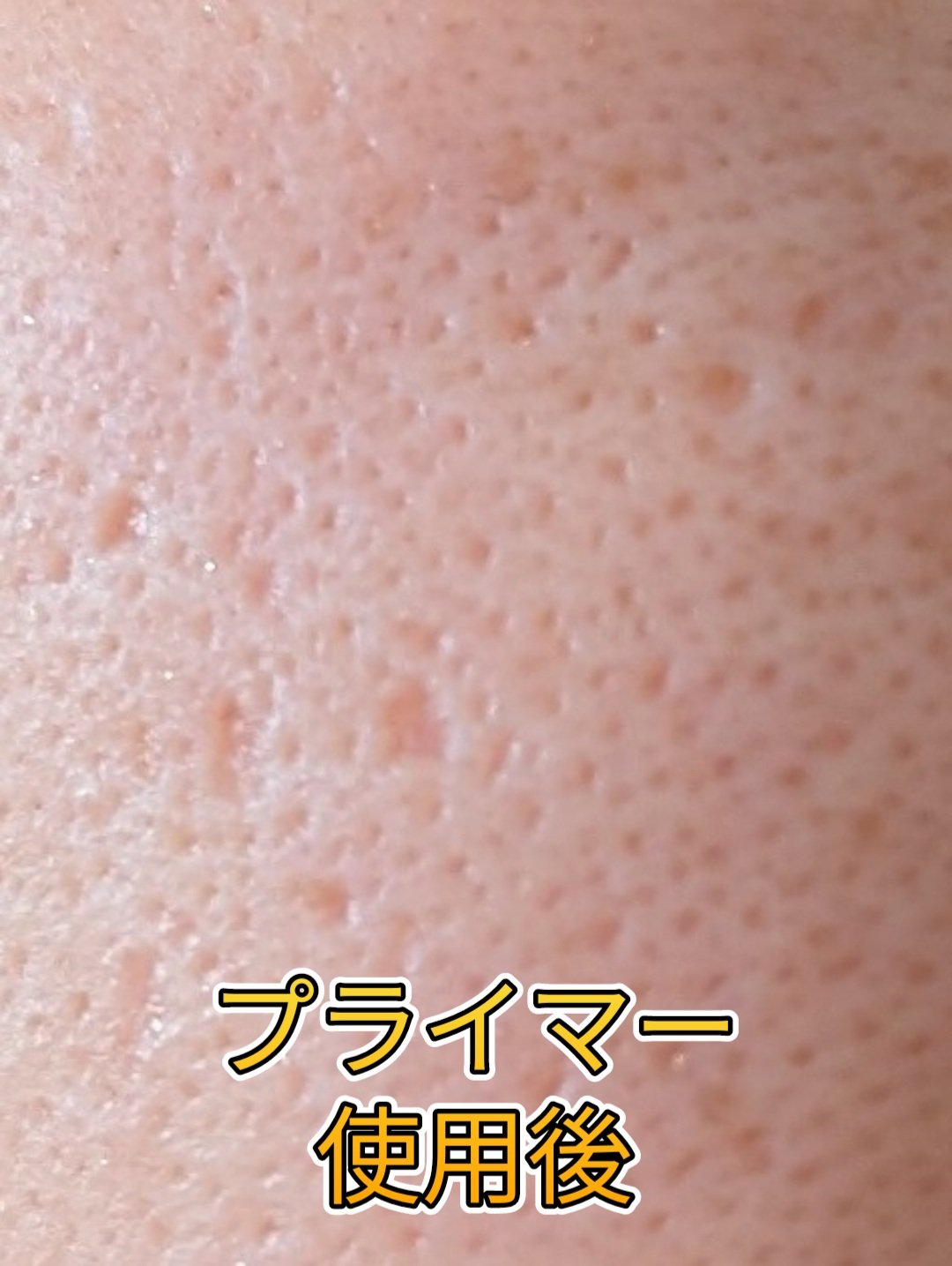 Borica 美容液マスクプライマー(シャンパン)のクチコミ「凹凹肌の私が、自分史上１番、毛穴隠せたプライマー
Boricaの美容液マスクプライマー！！

.....」（3枚目）