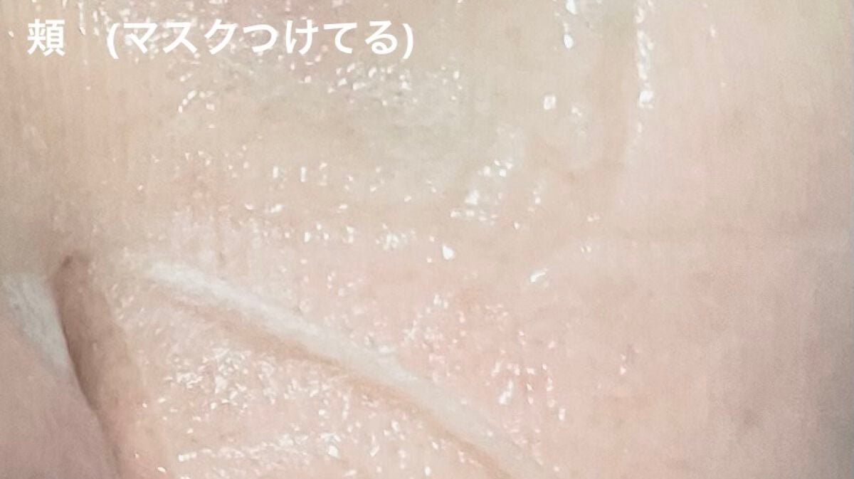 V9 ビタミン アンプルマスク クリア/JMsolution/シートマスク・パックを使ったクチコミ(7枚目)