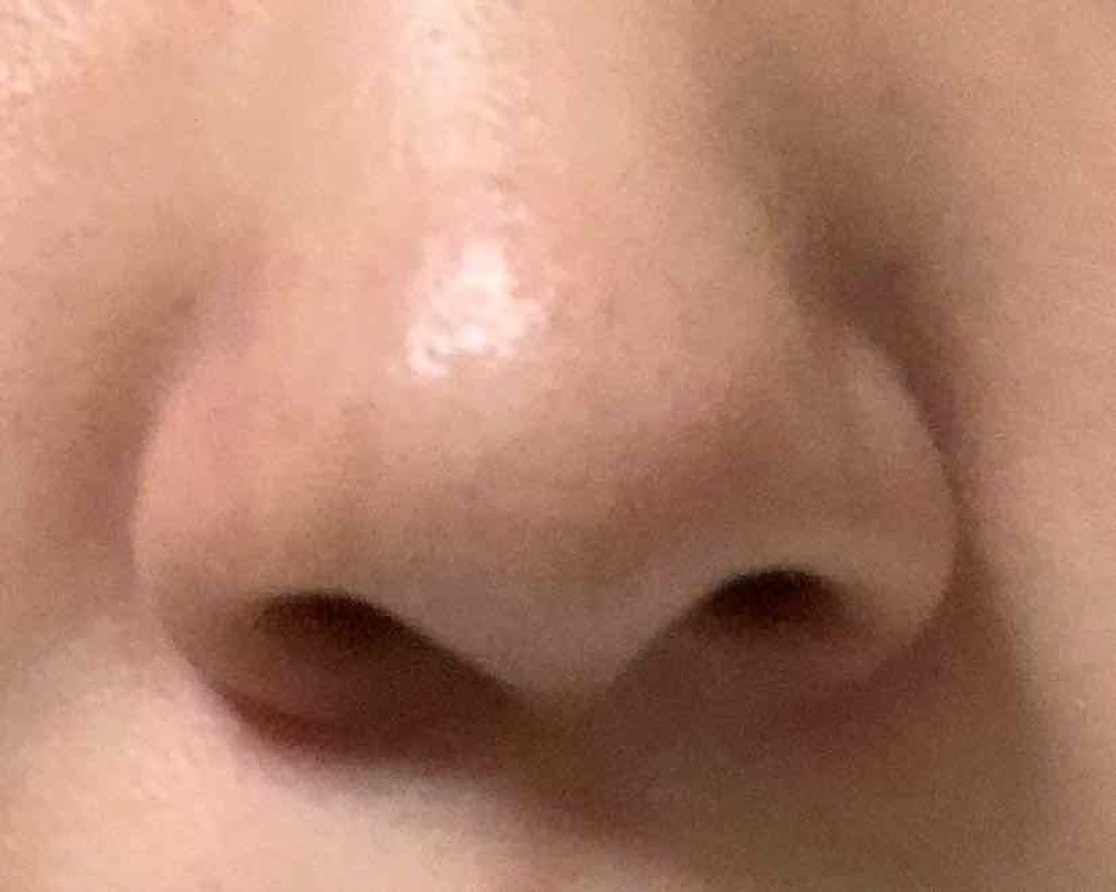 fabulous_make_sivz on LIPS 「3日経ちました。変わった!って感じしますか?コメント書いて欲し..」(3枚目)