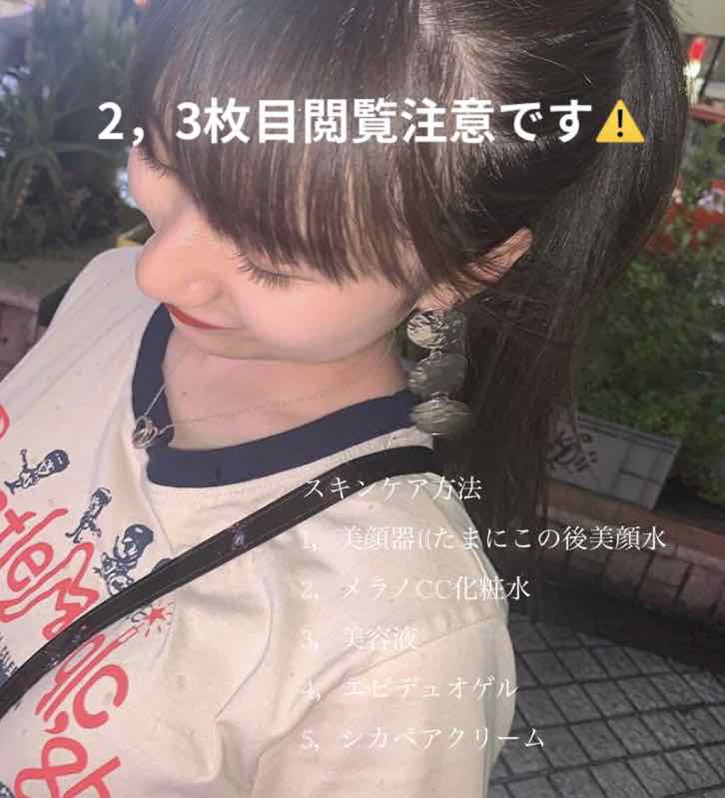 エピデュオゲル/マルホ株式会社/その他を使ったクチコミ（1枚目）