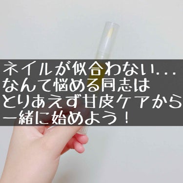 見よ！このブザマな爪の姿を。のぶしは地面をなめながら、気にしないフリまでして、しかもクーポン券を置いてまでネイリストから逃げ出している！だが！だからといってのぶしはセルフポリッシュを塗る資格を失いはしな