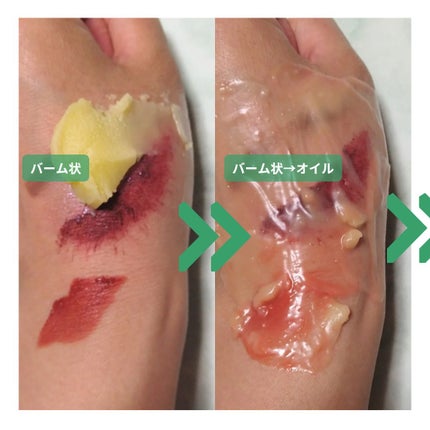 グリーンディープポアクレンジングバーム/Dr.G/クレンジングバームを使ったクチコミ(5枚目)