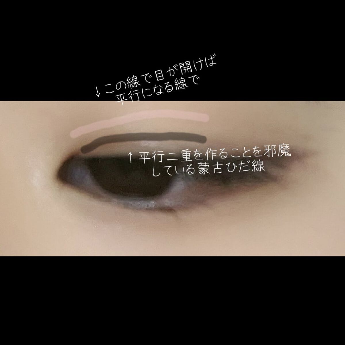 ケアリーヴ/ニチバン/その他を使ったクチコミ（2枚目）