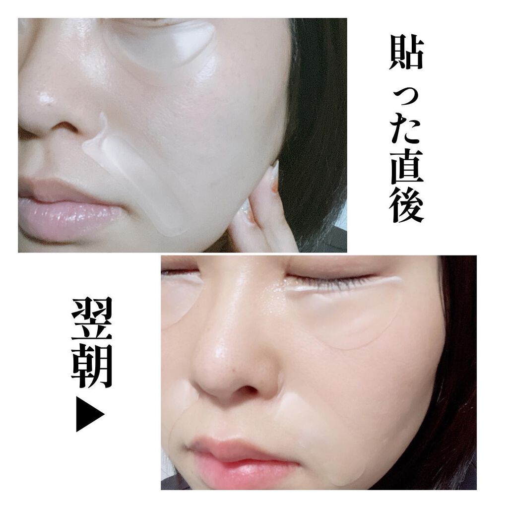 メディリフト 3Dマイクロフィラー(口元用)/YA-MAN TOKYO JAPAN/シートマスク・パックを使ったクチコミ(6枚目)