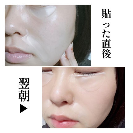 メディリフト 3Dマイクロフィラー(口元用)/YA-MAN TOKYO JAPAN/シートマスク・パックを使ったクチコミ(6枚目)