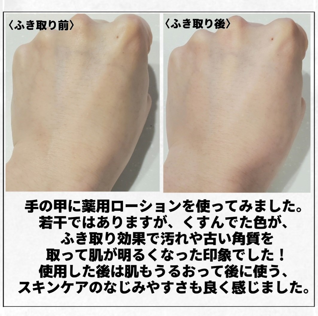 ネイチャーコンク 薬用クリアローション/ネイチャーコンク/拭き取り化粧水を使ったクチコミ（3枚目）