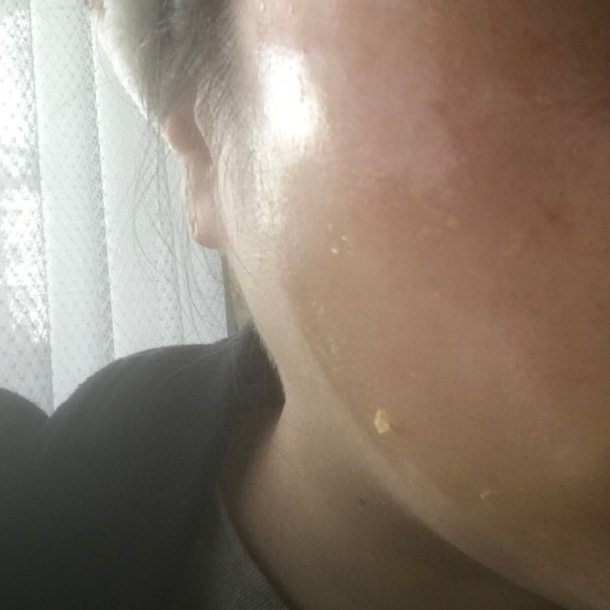 リアルカレンデュラピールオフパック/APRILSKIN/ピーリングを使ったクチコミ(2枚目)