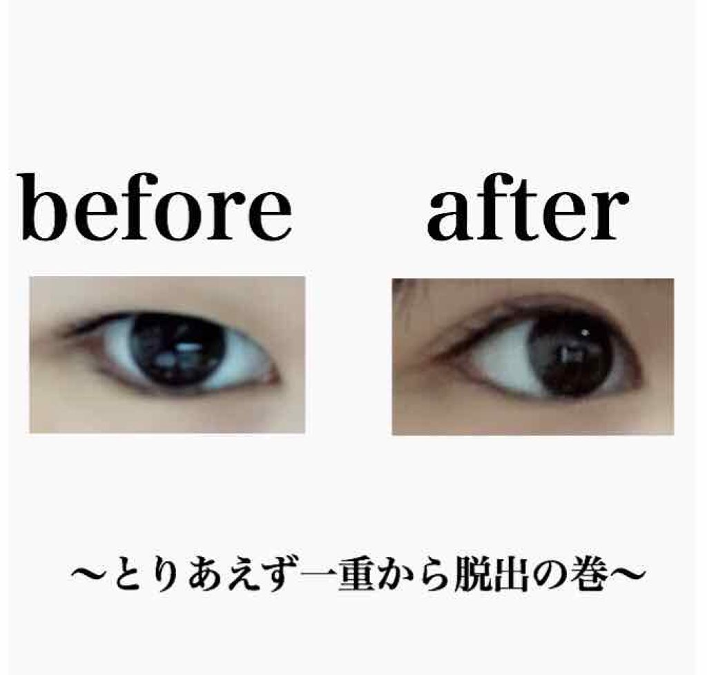 アイトーク/アイトーク/二重まぶた用アイテムを使ったクチコミ（2枚目）