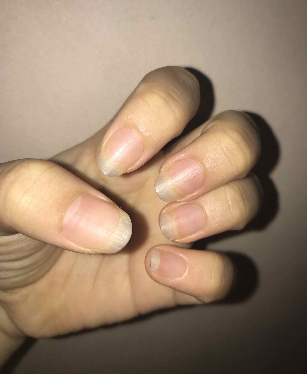 ウィンマックス キューティクルオイル/DAISO/ネイルオイル・トリートメントを使ったクチコミ（1枚目）