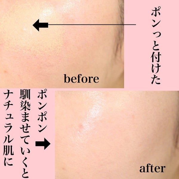 スーパーシカクッション/MEDICUBE/クッションファンデーション by COLOさん˚✧₊⁎❝᷀ົཽ≀ˍ̮ ❝᷀ົཽ⁎⁺˳✧༚