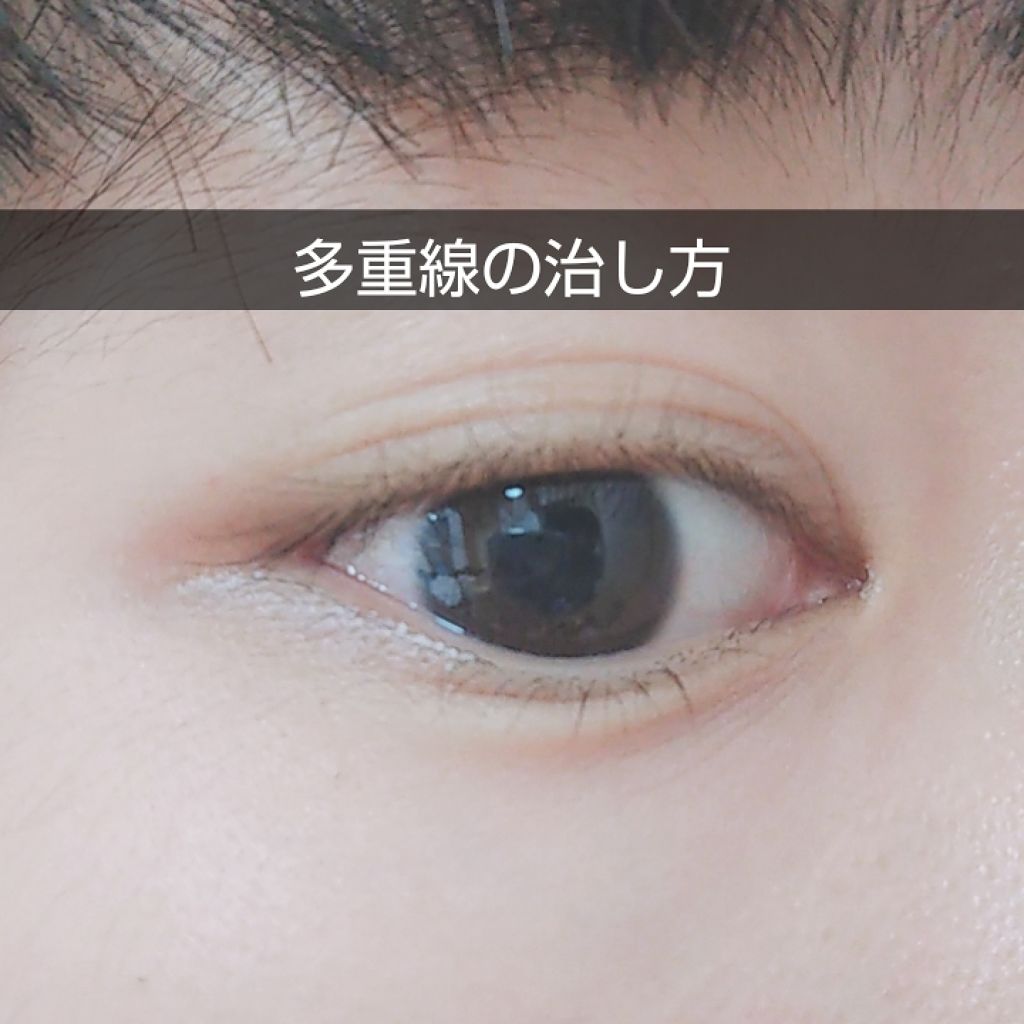 アイテープ 埋没式両面テープ/DAISO/二重まぶた用アイテムを使ったクチコミ(1枚目)