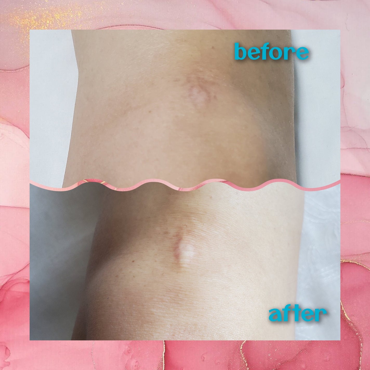 ナイアシンアミド 5% ボディローション/b.clinicx/ボディローションを使ったクチコミ(6枚目)