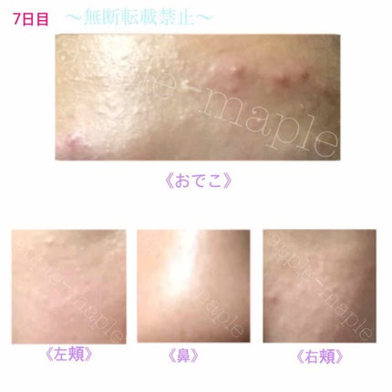 ロゼット 洗顔パスタ 荒性肌/ロゼット/洗顔フォームを使ったクチコミ(4枚目)