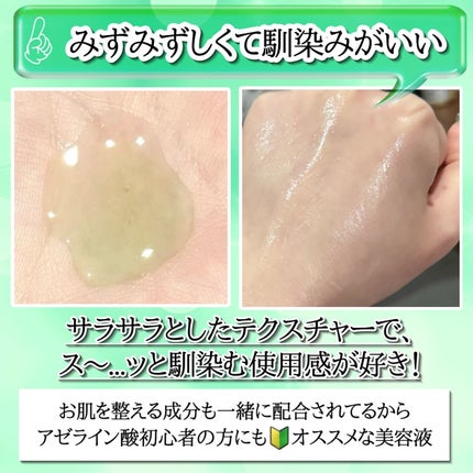 アゼライン酸15 インテンスカーミングセラム/Anua/美容液を使ったクチコミ(5枚目)