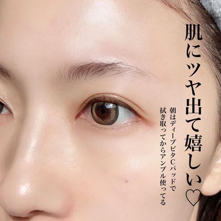 AGE-Rダーマエアショット/MEDICUBE/美顔器・マッサージを使ったクチコミ(8枚目)