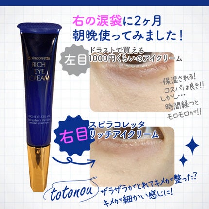 スピラコレッタ リッチアイクリーム/日本ライフ製薬/アイケア・アイクリームを使ったクチコミ(2枚目)