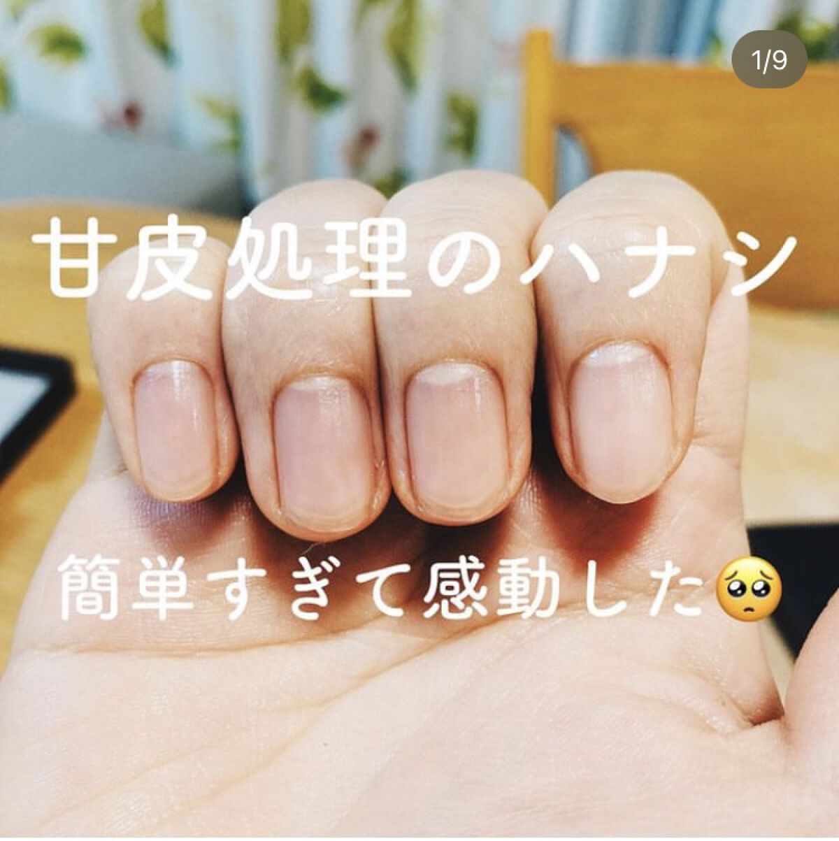 クナイプビオ オイル 20mL （旧パッケージ）/クナイプ/ボディオイルを使ったクチコミ（1枚目）