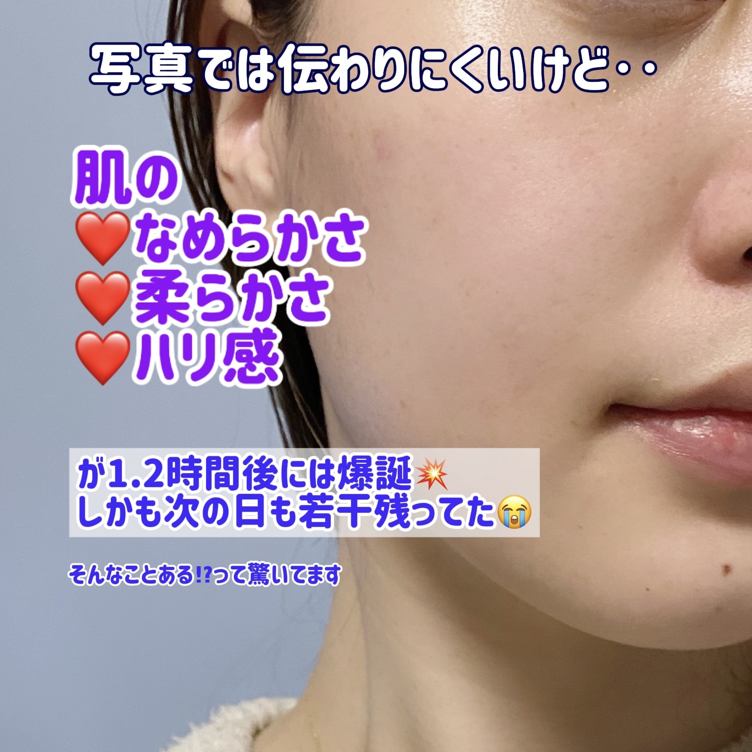 アットクリニック ボルフィリン リンクルショット アンプル/DOMINAS/美容液を使ったクチコミ（3枚目）