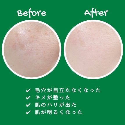 リードルショット300/VT/美容液を使ったクチコミ(2枚目)