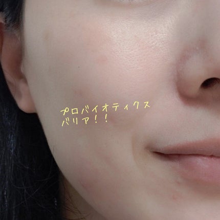 ビフィダバイオームコンプレックスセラム/manyo/美容液を使ったクチコミ(4枚目)