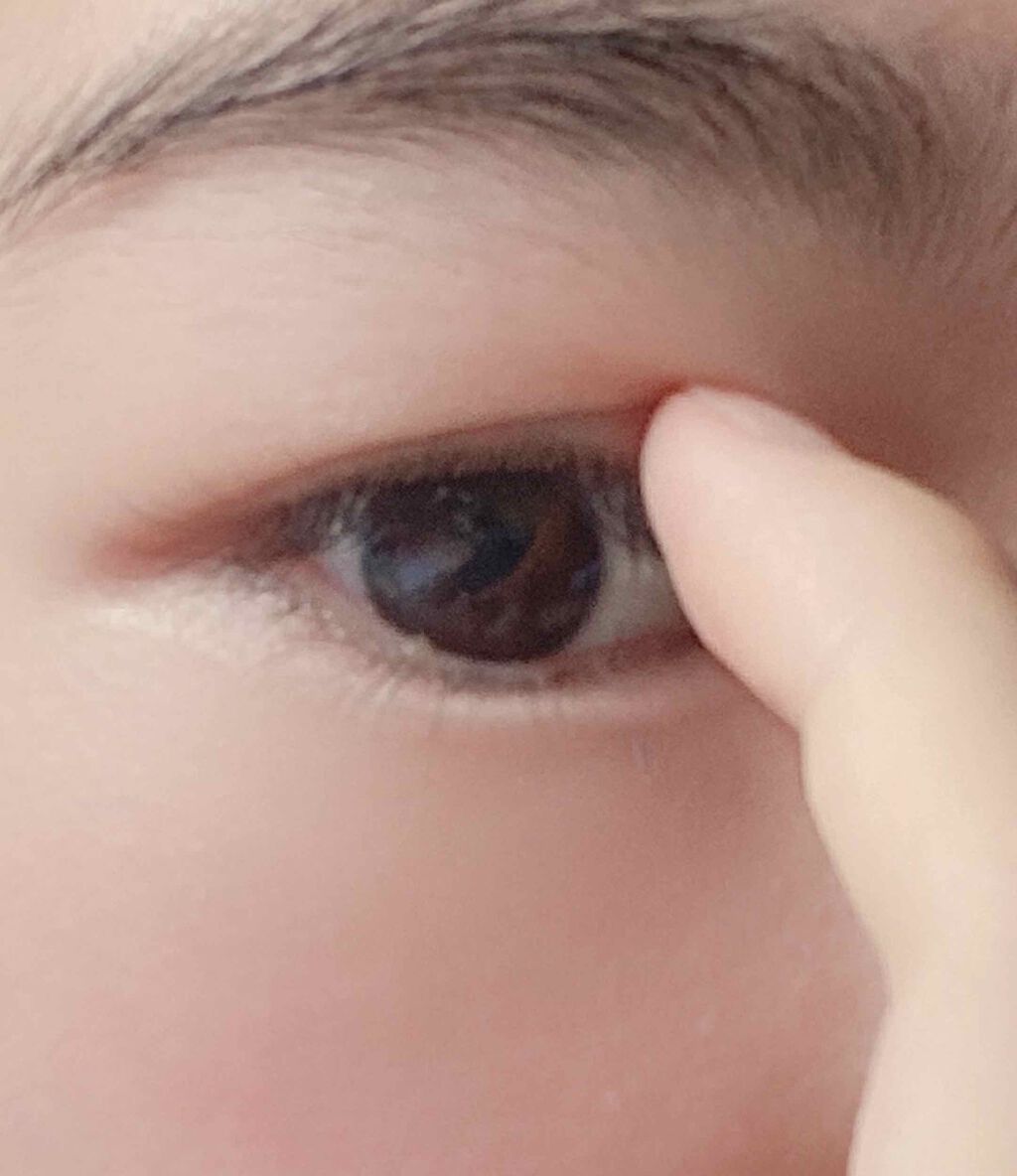 サンテ ボーティエ(医薬品)/参天製薬/その他を使ったクチコミ(2枚目)