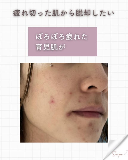 エッセンシャル トリートメントローション/ロベクチン/化粧水を使ったクチコミ(3枚目)