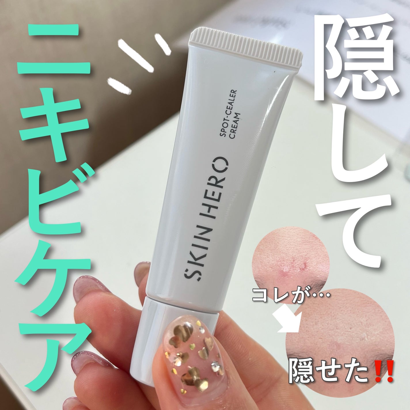 薬用スポットシーラークリーム/スキンヒーロー/クリームコンシーラーを使ったクチコミ(1枚目)