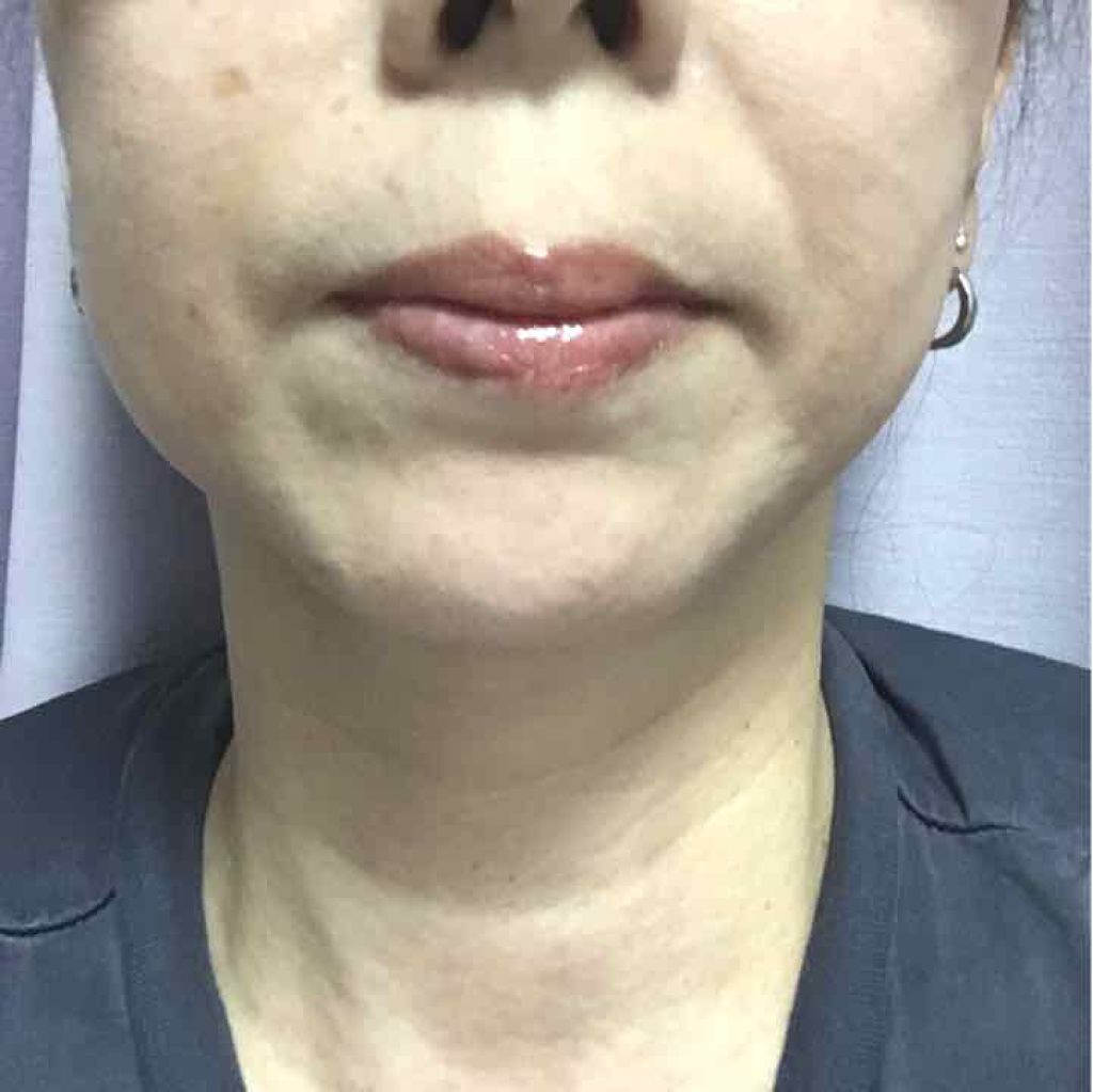 WHITE WHIPPING CREAM(ウユクリーム)/G9SKIN/化粧下地を使ったクチコミ（1枚目）