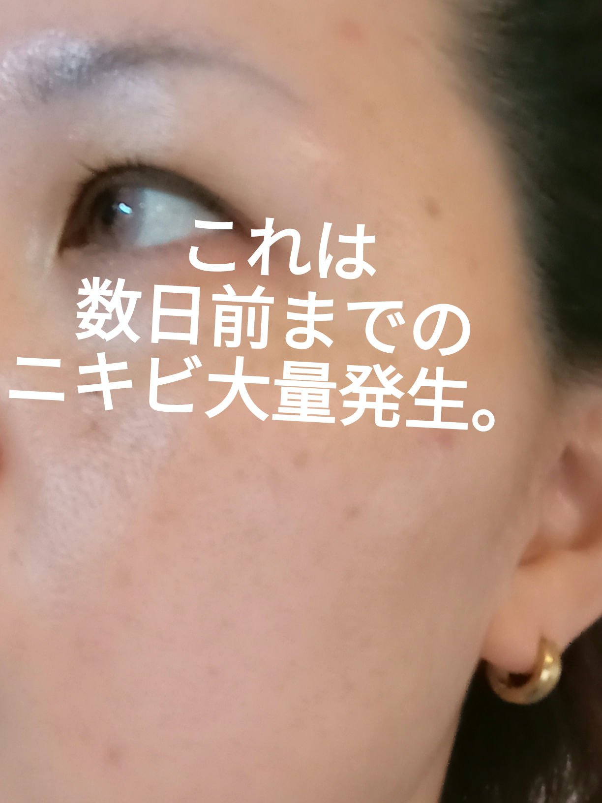 カバーパーフェクション チップコンシーラー/the SAEM/リキッドコンシーラーを使ったクチコミ（2枚目）