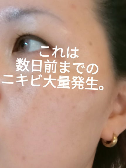 カバーパーフェクション チップコンシーラー/the SAEM/リキッドコンシーラーを使ったクチコミ(2枚目)