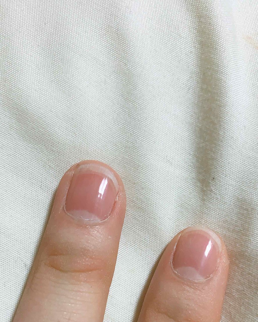 ねむみんご🌾 on LIPS 「爪&手汚くてすみません💦😱😱😱😱😱ダイソーの爪磨きで爪を磨いて..」(2枚目)