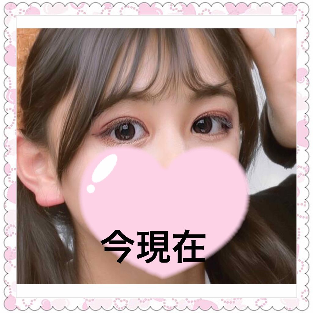 shiny on LIPS 「中学時代、プリクラでも盛れなかった私がここまでマシになりました..」(3枚目)