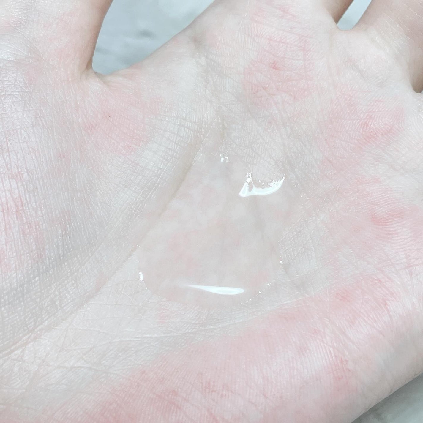 ファイン100/imini/美容液を使ったクチコミ(3枚目)