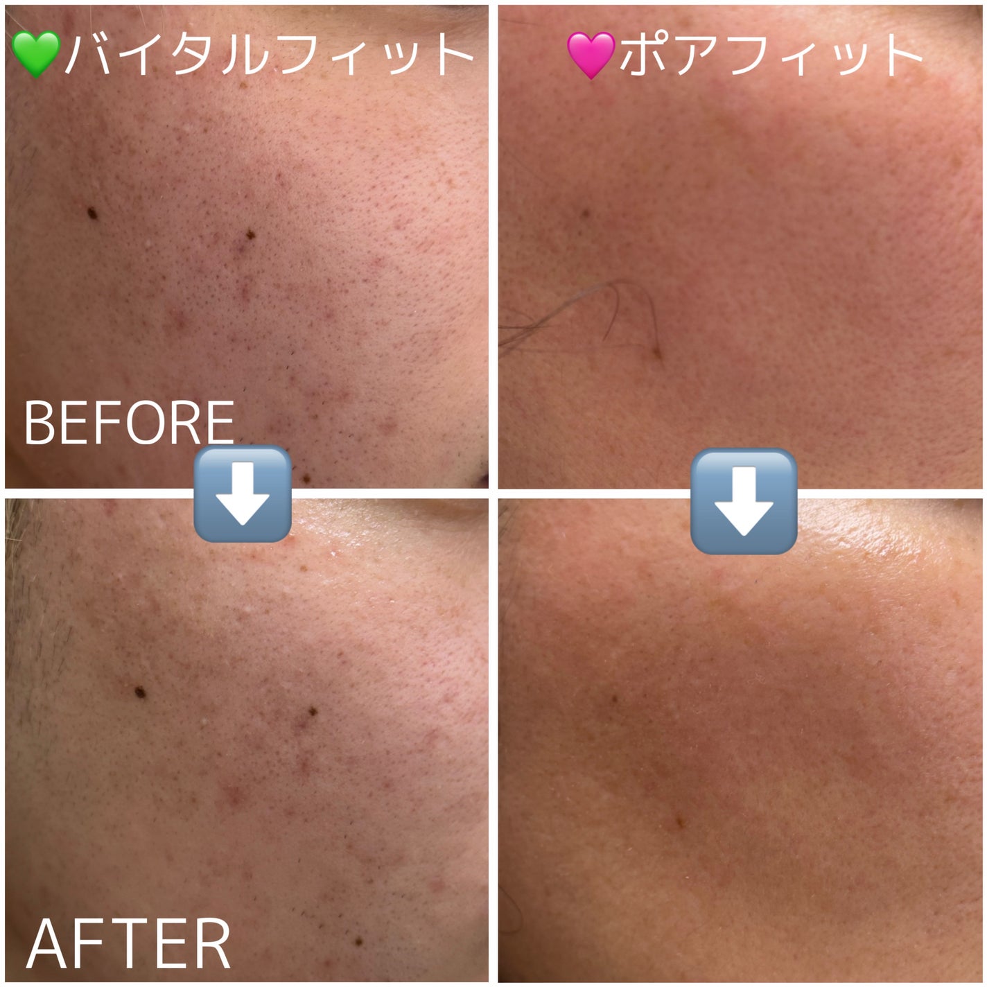 PHセンシティブマスク バイタルフィット/SAM'U/シートマスク・パックを使ったクチコミ(4枚目)