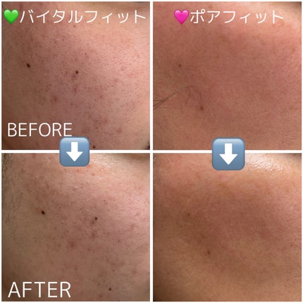 PHセンシティブマスク バイタルフィット/SAM'U/シートマスク・パックを使ったクチコミ(4枚目)