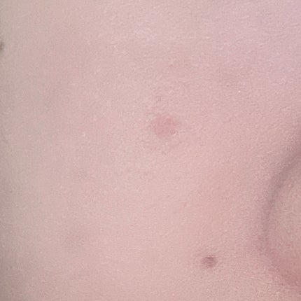 薬用コンシーラー アクネプロテクター/ONLY MINERALS/パウダーコンシーラーを使ったクチコミ(6枚目)