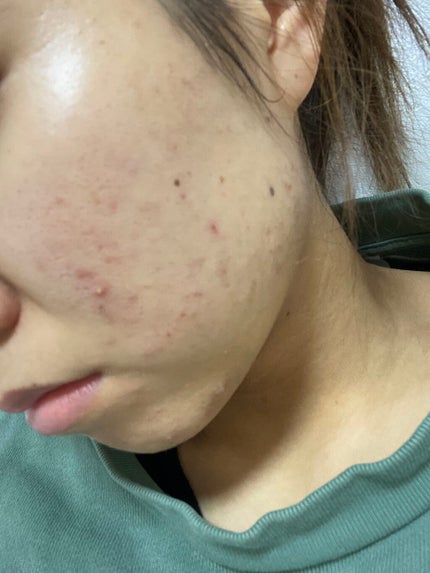 を使ったクチコミ(2枚目)