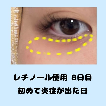 レチノールインテンシブ アドバンスドトリプルアクションアイクリーム/SOME BY MI/アイケア・アイクリームを使ったクチコミ(4枚目)