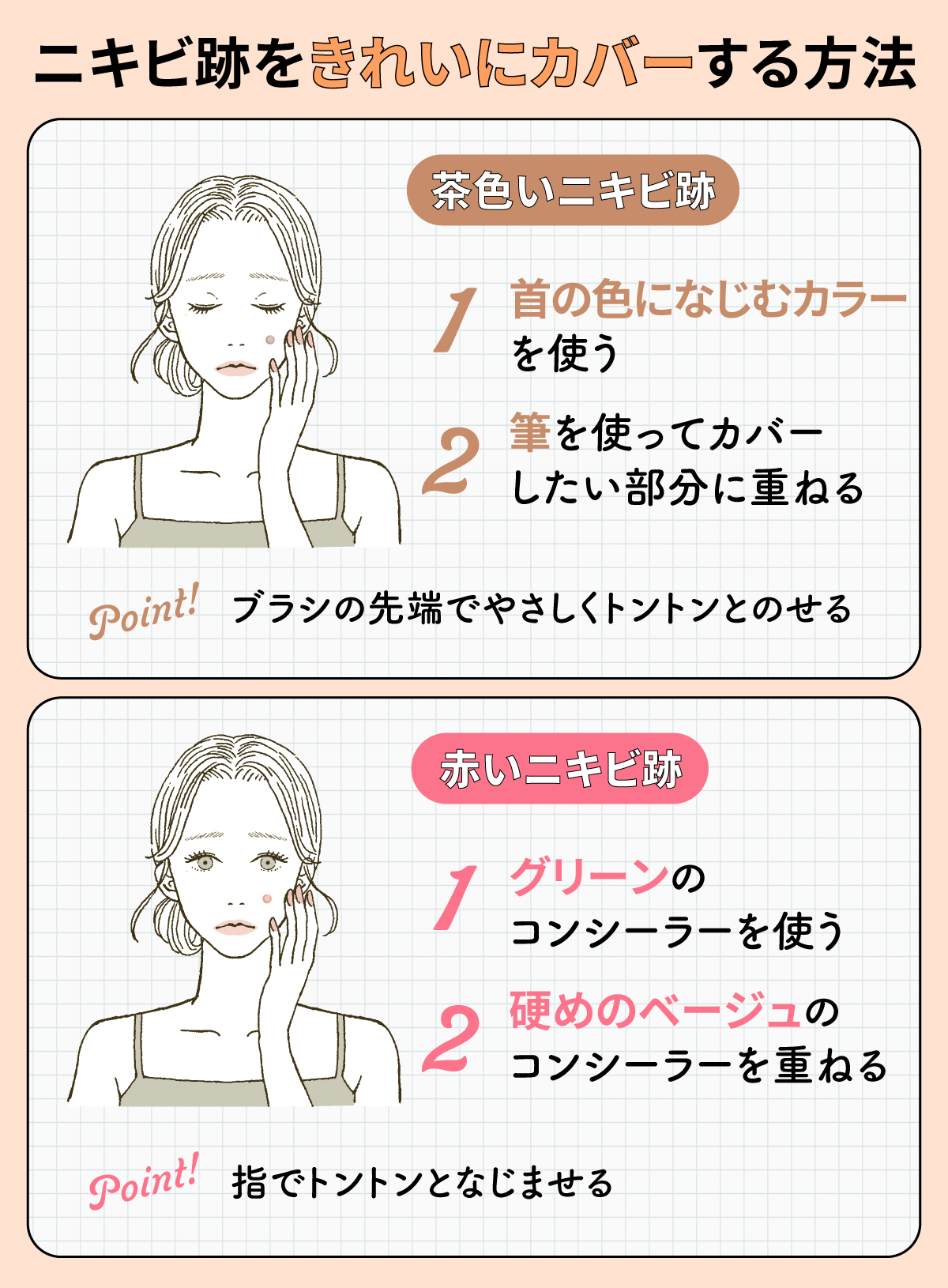ニキビ跡をきれいにカバーする方法。茶色いニキビ跡は首の色になじむカラーを使い、筆を使ってカバーしたい部分に重ねる。ブラシの先端でやさしくトントンとのせるのがポイント。赤いニキビ跡はグリーンのコンシーラーを使い、硬めのベージュのコンシーラーを重ねる。指でトントンとなじませるのがポイント。
