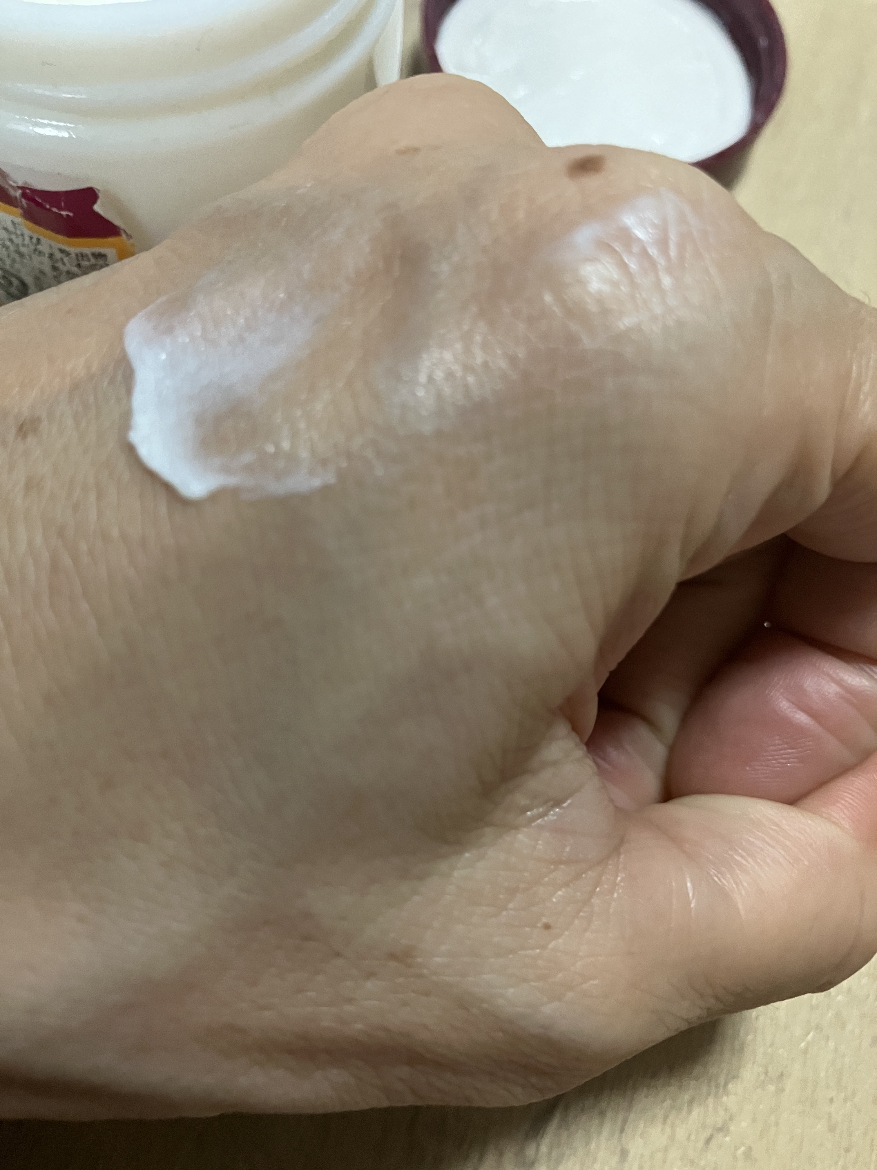 オロナインＨ軟膏 (医薬品)/オロナイン/その他を使ったクチコミ（3枚目）