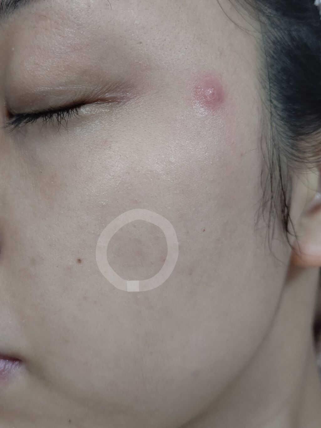 クリアケア 薬用アクネ美容液/無印良品/美容液を使ったクチコミ（3枚目）